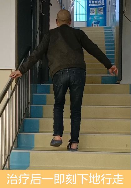 3-治疗后下地行走.jpg
