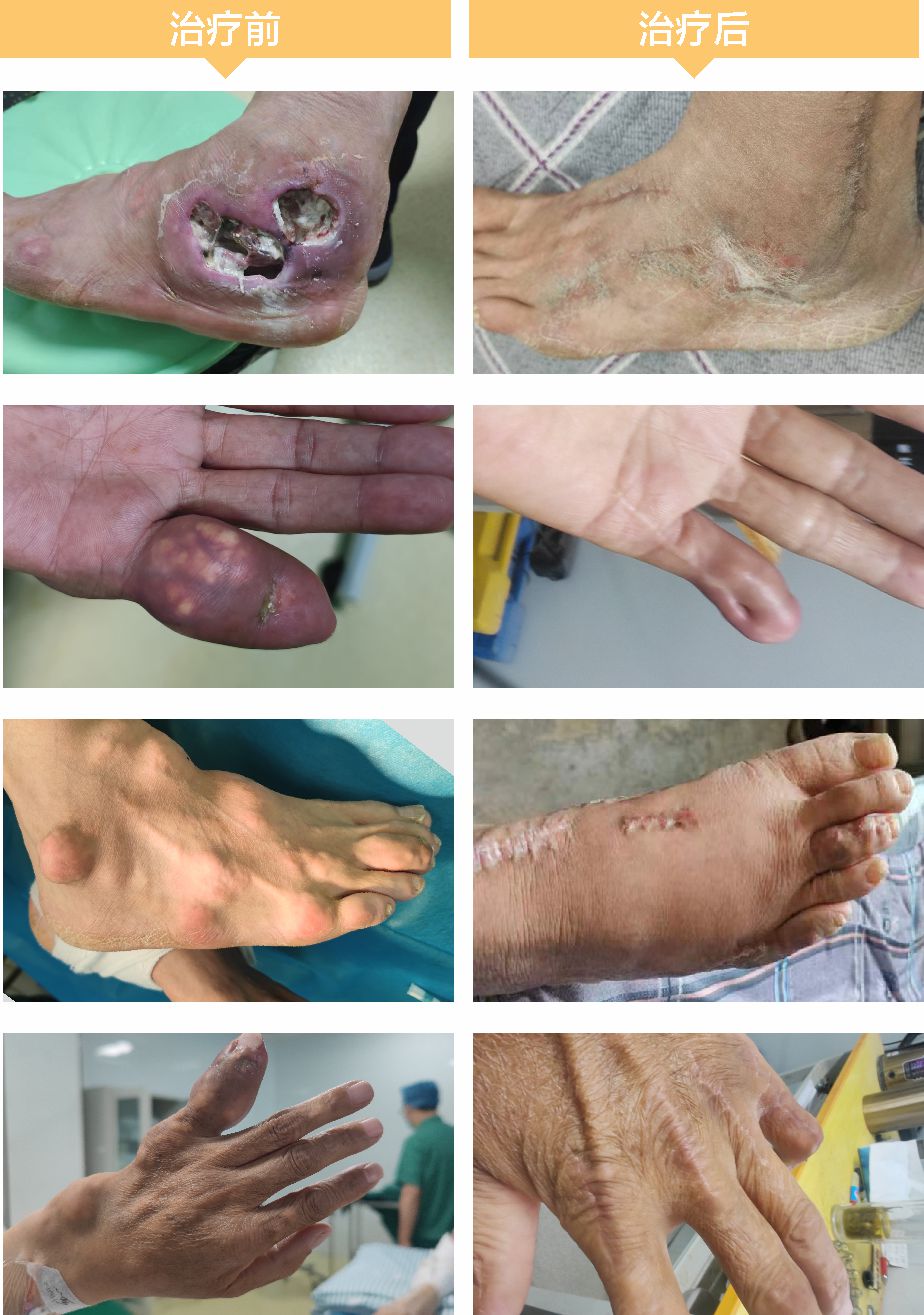 2-治疗前后.jpg